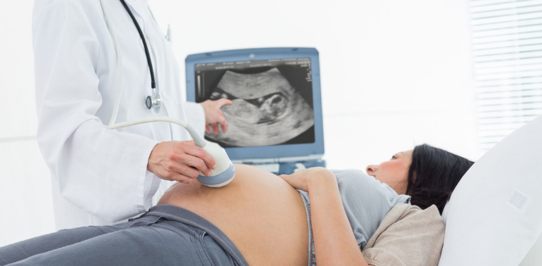 Ultrasonografi (USG)